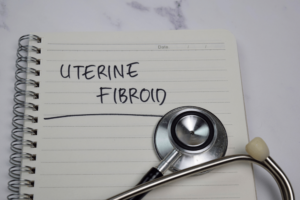 How Is Uterine Fibroid Embolization Performed
